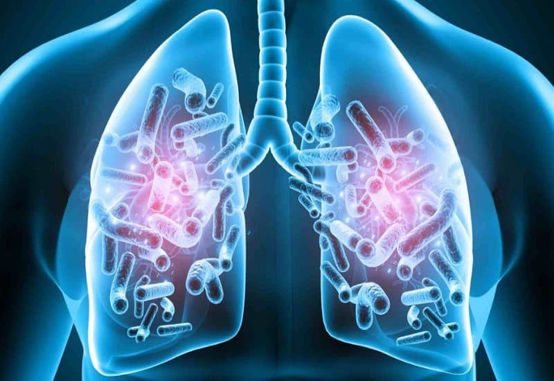 bệnh về đường hô hấp