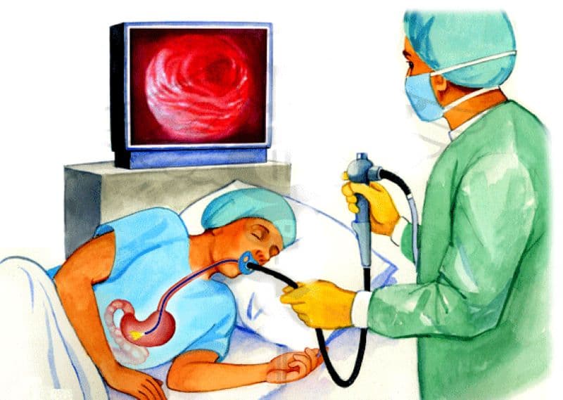 triệu chứng sau khi nội soi dạ dày