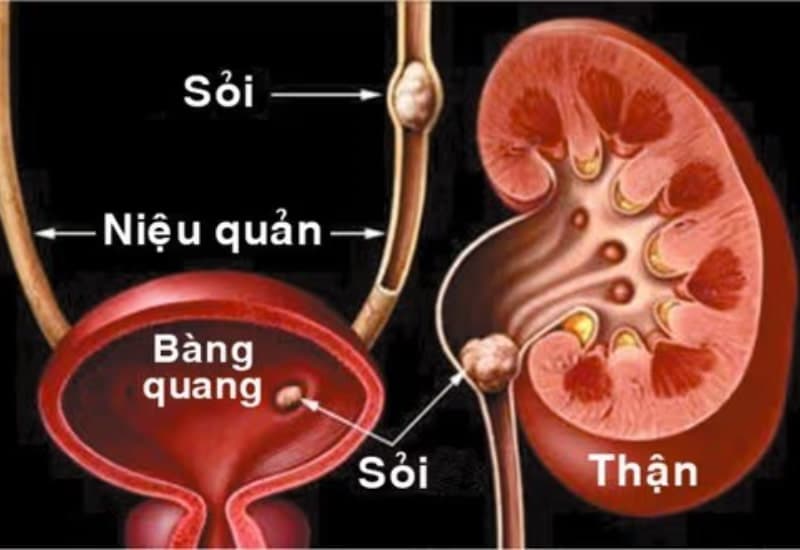 bld trong xét nghiệm nước tiểu là gì
