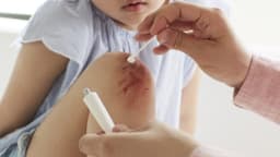 Rắc/ bôi thuốc kháng sinh vào vết thương hở có sao không?