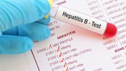 Các bước khám viêm gan B – cần khám những gì?