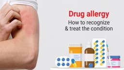 Có thể tự chữa dị ứng thuốc kháng sinh tại nhà không?