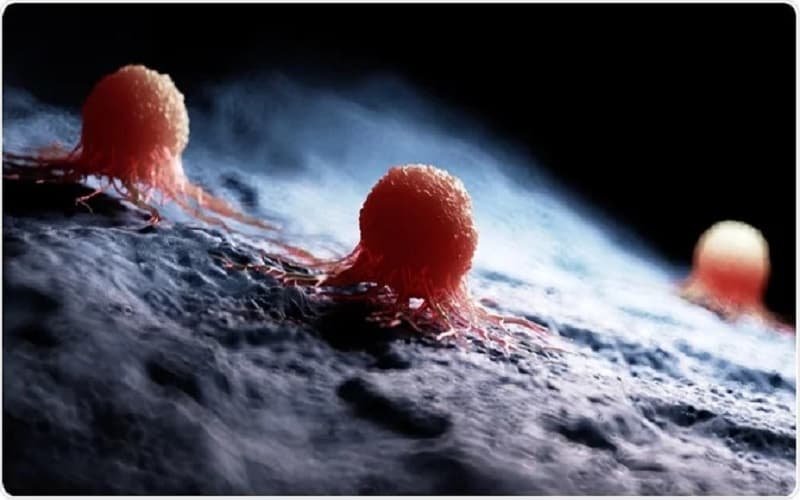 carcinoma là ung thư gì