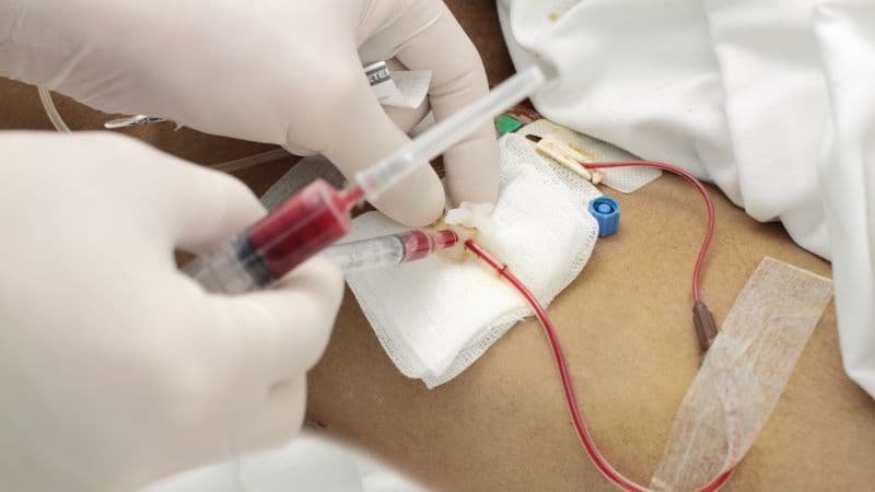 chẩn đoán suy hô hấp Bộ Y tế