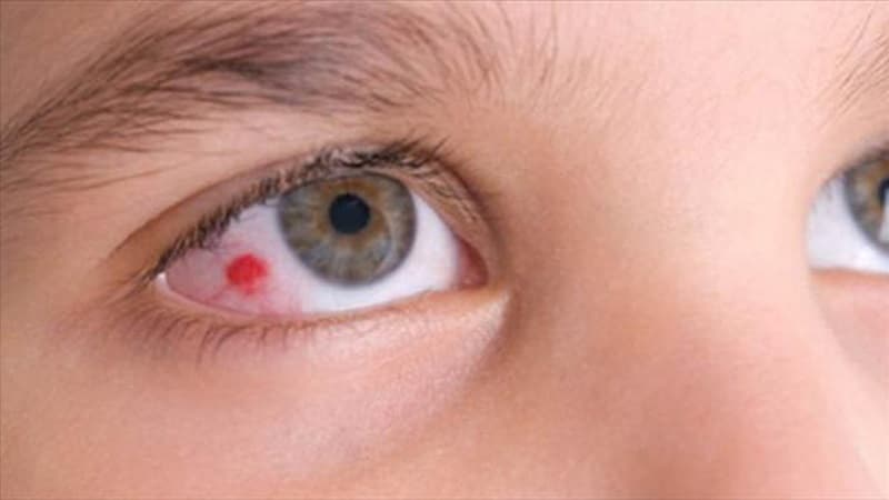 vật nhọn đâm vào mắt