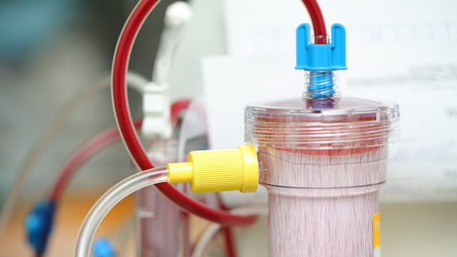 Nhiễm trùng máu ở bệnh nhân chạy thận nhân tạo mãn tính