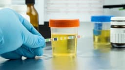 Chỉ số glucose trong nước tiểu bà bầu bao nhiêu là tốt?