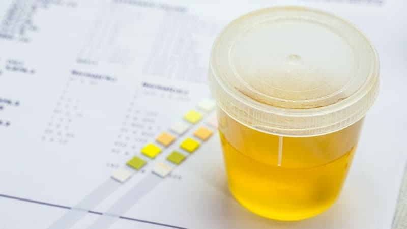 chỉ số glucose trong nước tiểu bà bầu