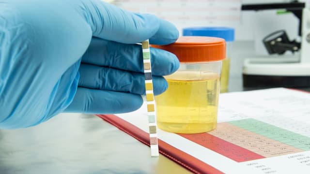 Chỉ số LEU trong nước tiểu bà bầu có ý nghĩa gì?