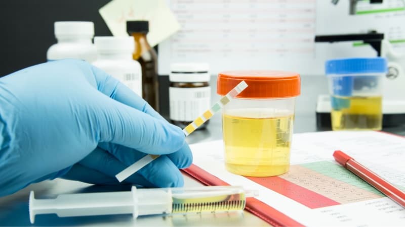 chỉ số LEU trong nước tiểu bà bầu