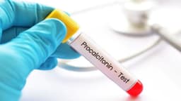 Các chỉ số xét nghiệm nhiễm trùng máu