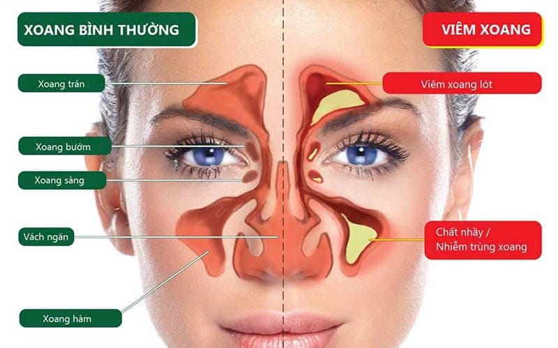 xoang mũi có chức năng gì trong hệ hô hấp