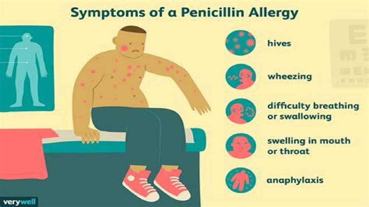 Khắc phục dị ứng penicillin: Các giải pháp thay thế an toàn