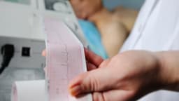 Điện tim thường là gì? Giúp phát hiện vấn đề gì của tim?