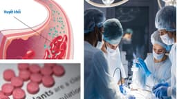 Dùng thuốc chống đông trong phẫu thuật cần lưu ý gì?