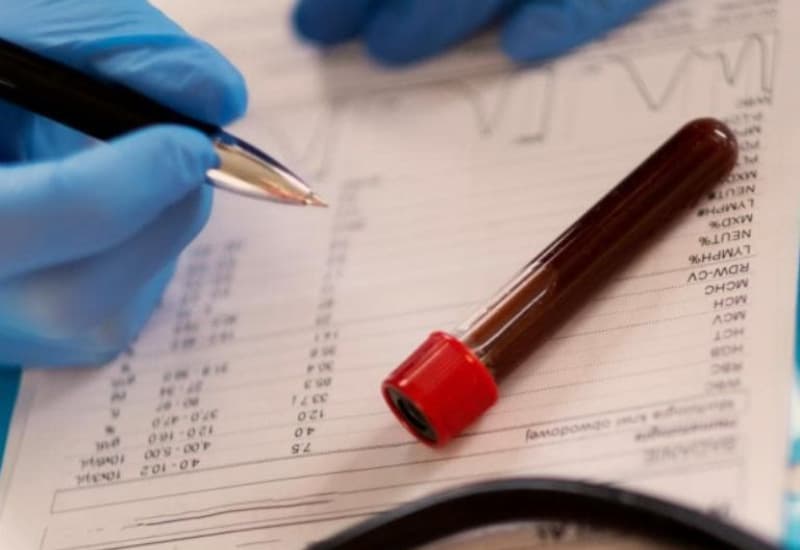 xét nghiệm EGFR ung thư phổi