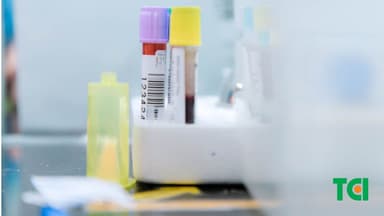 Khám tổng quát có xét nghiệm máu không?