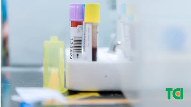 Khám tổng quát có xét nghiệm máu không?