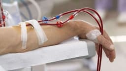 Chỉ định lọc máu khi bị nhiễm trùng máu