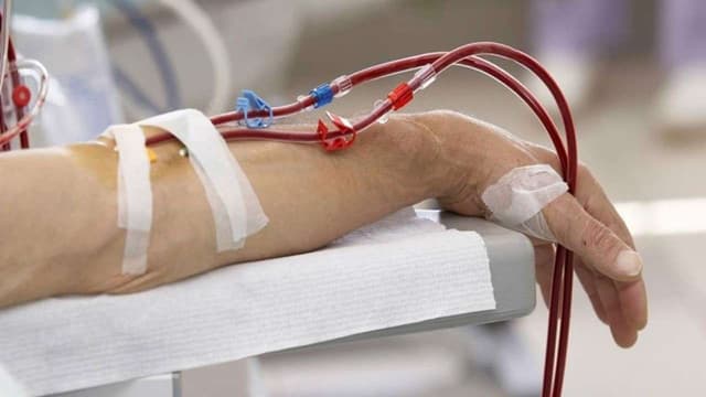 Chỉ định lọc máu khi bị nhiễm trùng máu