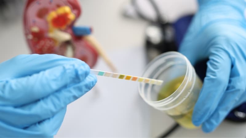 lượng protein trong nước tiểu của bà bầu