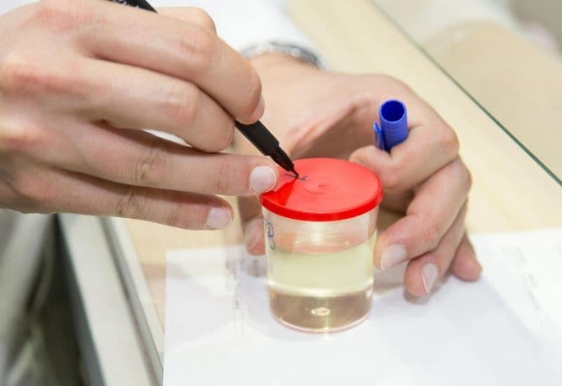 mẹ bầu xét nghiệm nước tiểu để làm gì