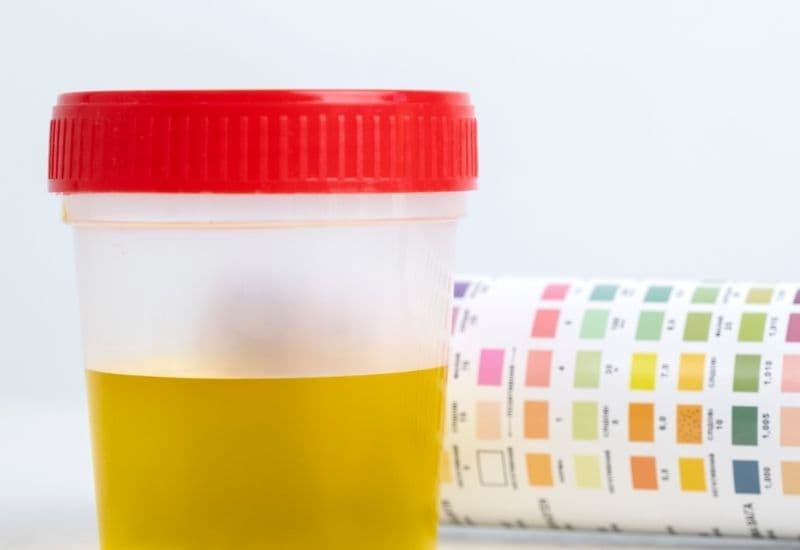 mẹ bầu xét nghiệm nước tiểu để làm gì