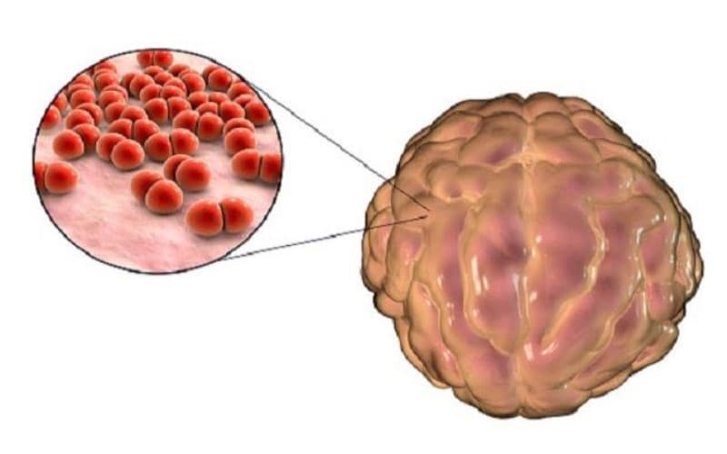 liều meropenem trong viêm màng não