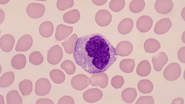 Chỉ số Mono cao trong xét nghiệm máu là gì?