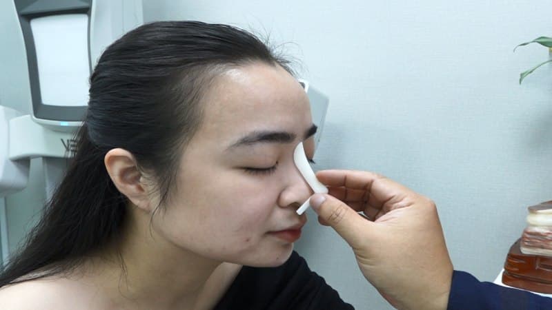 thuốc kháng sinh sau nâng mũi