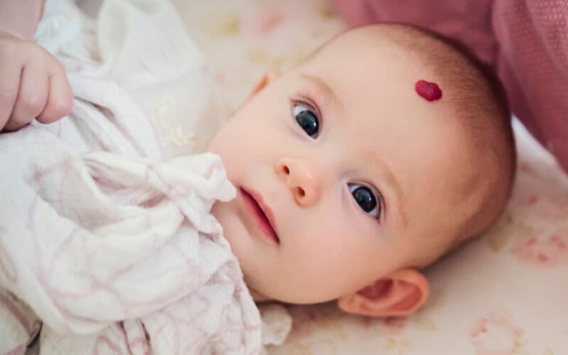 u máu ở trẻ sơ sinh nguyên nhân