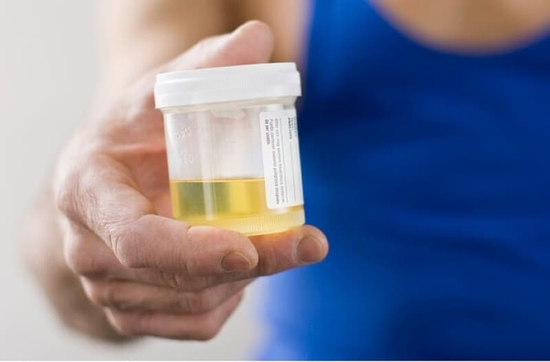 nước tiểu bà bầu màu gì