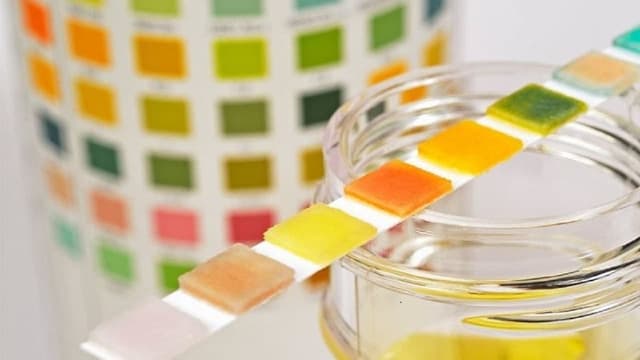 Những thay đổi trong nước tiểu: Nguyên nhân, triệu chứng và cách điều trị