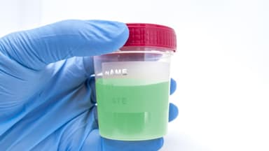 Vì sao nước tiểu màu xanh lá cây?