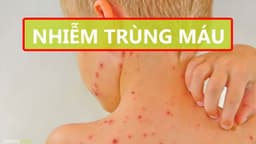 Hiện tượng phát ban nhiễm trùng máu