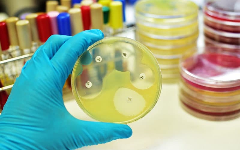 phổ kháng khuẩn của kháng sinh