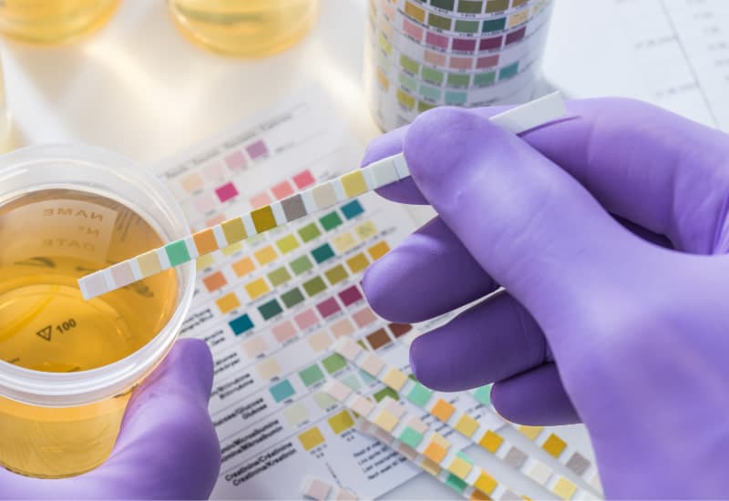 pro trong xét nghiệm nước tiểu là gì