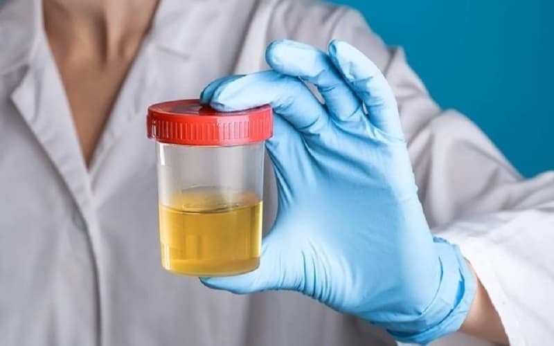 siêu âm có phát hiện ra suy thận không