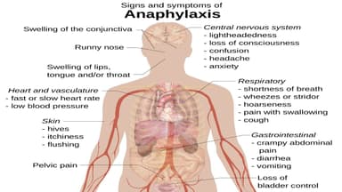 Sốc thuốc kháng sinh là gì? Có nguy hiểm không?