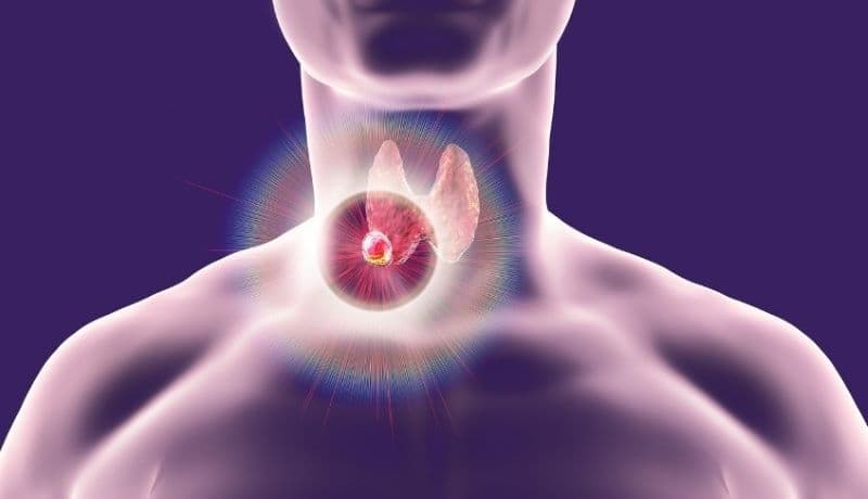 bệnh suy giáp có phải mổ không