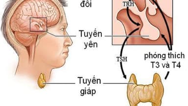 Suy giáp do suy tuyến yên