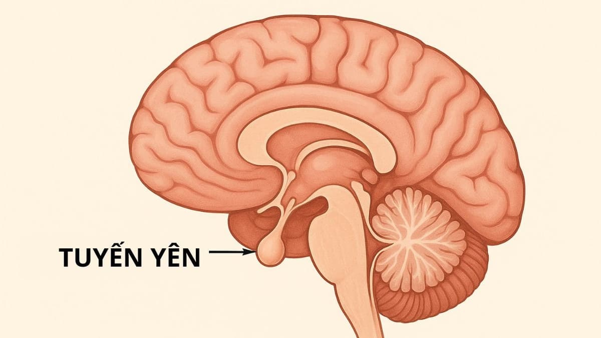Bệnh suy tuyến yên có chữa được không? Có nguy hiểm không?