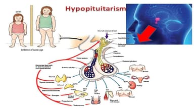 Suy tuyến yên là bệnh gì? Nguyên nhân?