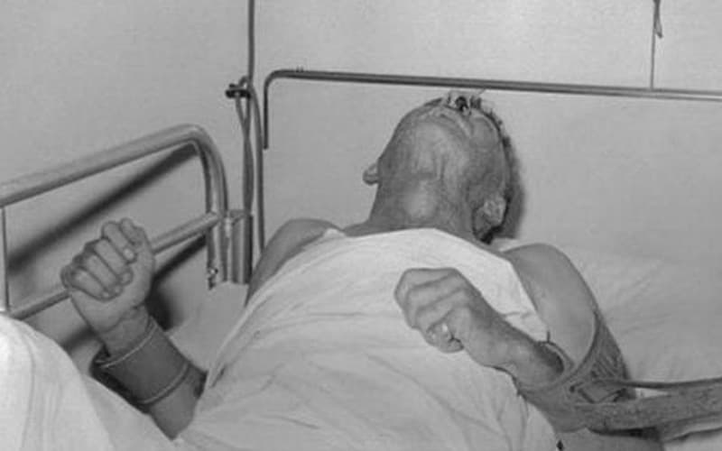 tại sao bệnh dại lại sợ nước