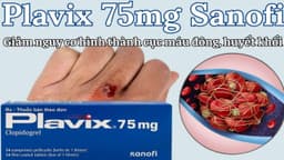 Uống thuốc chống đông plavix 75mg lâu ngày có sao không?