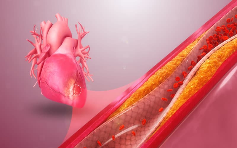 thuốc chống đông clopidogrel