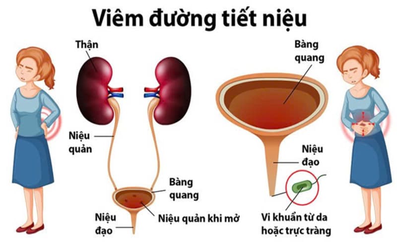 thuốc kháng sinh levofloxacin