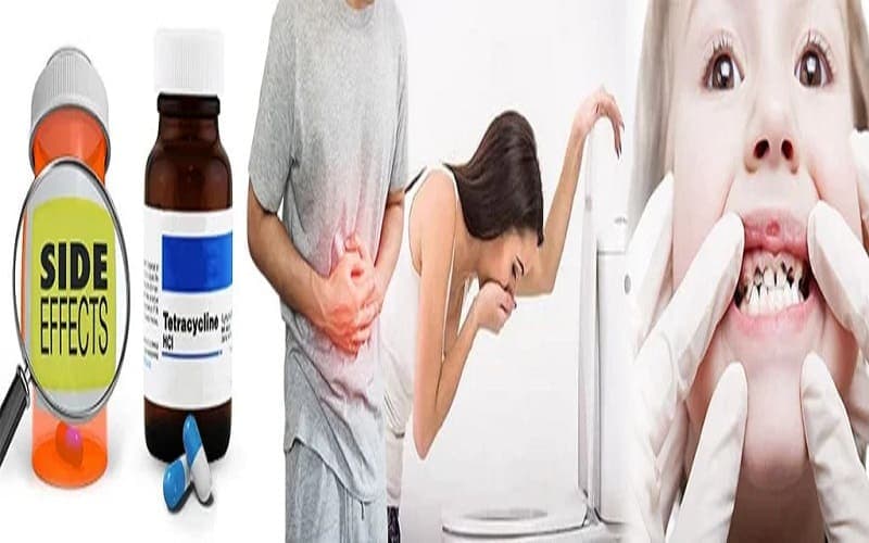 thuốc kháng sinh tetracyclin