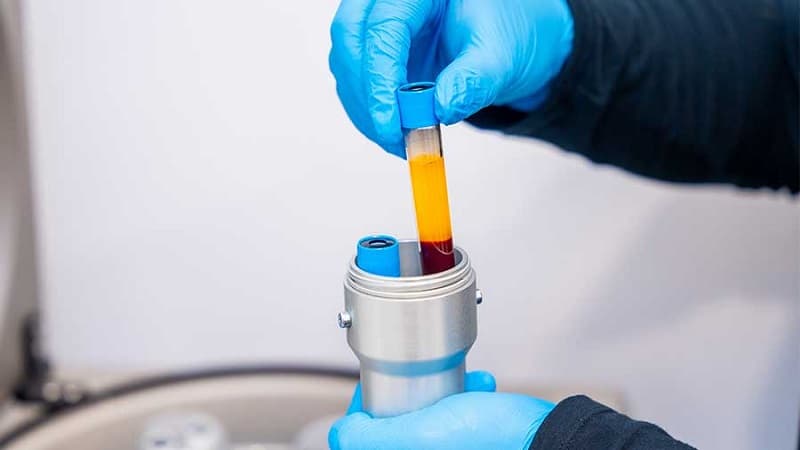 huyết tương giàu tiểu cầu tự thân