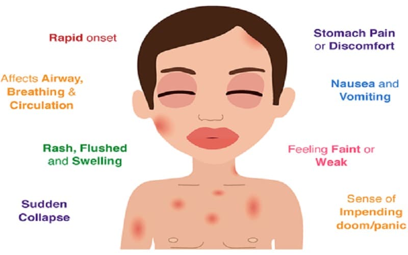 sốc thuốc kháng sinh